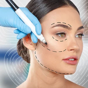 Face-lift